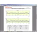 Surftest SJ-412 [мм] R2 мкм; 0,75 мН; X=50 мм 178-582-31D Mitutoyo
